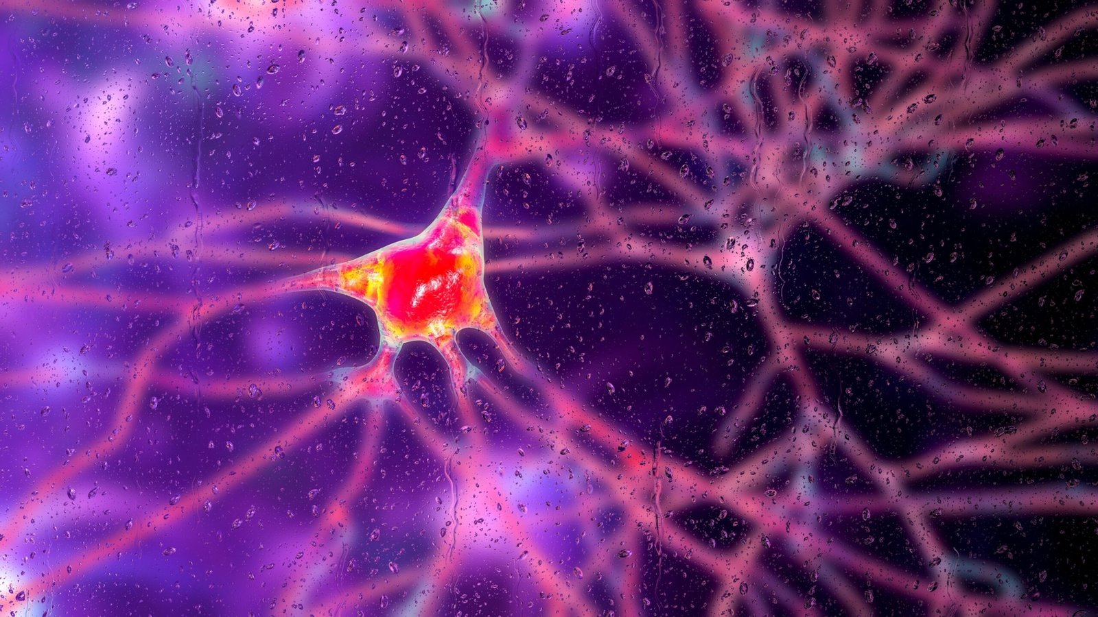 Photo: Dementia neurons, conceptual illustration